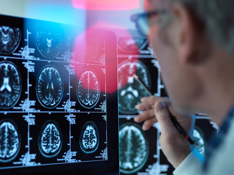 Doctor examining brain scans